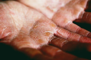 Hands resting against soft fabric